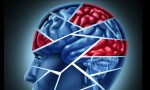 traumatic brain injury graphic