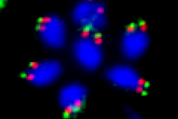 Centrosome picture 2